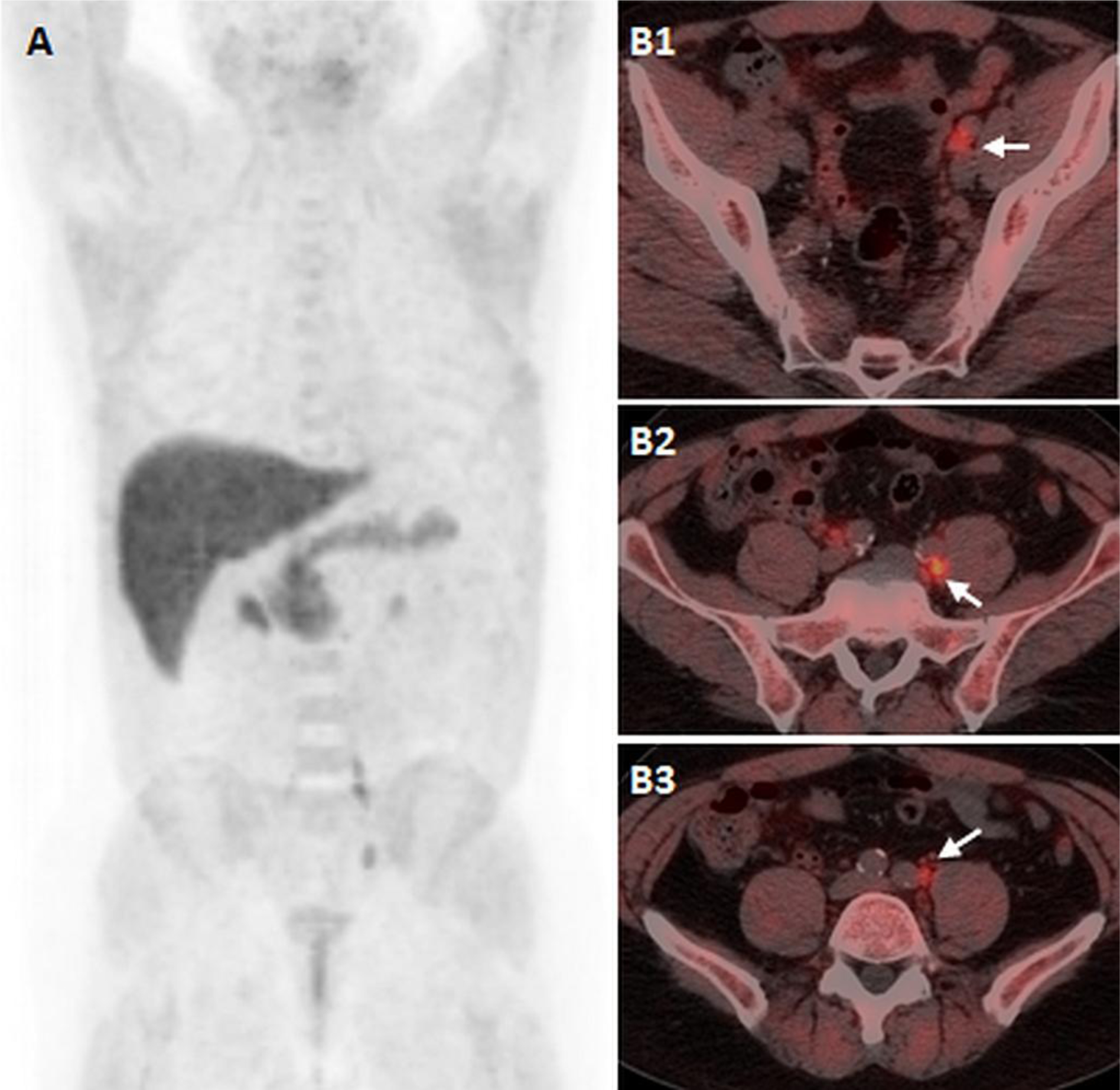 Figure 1: