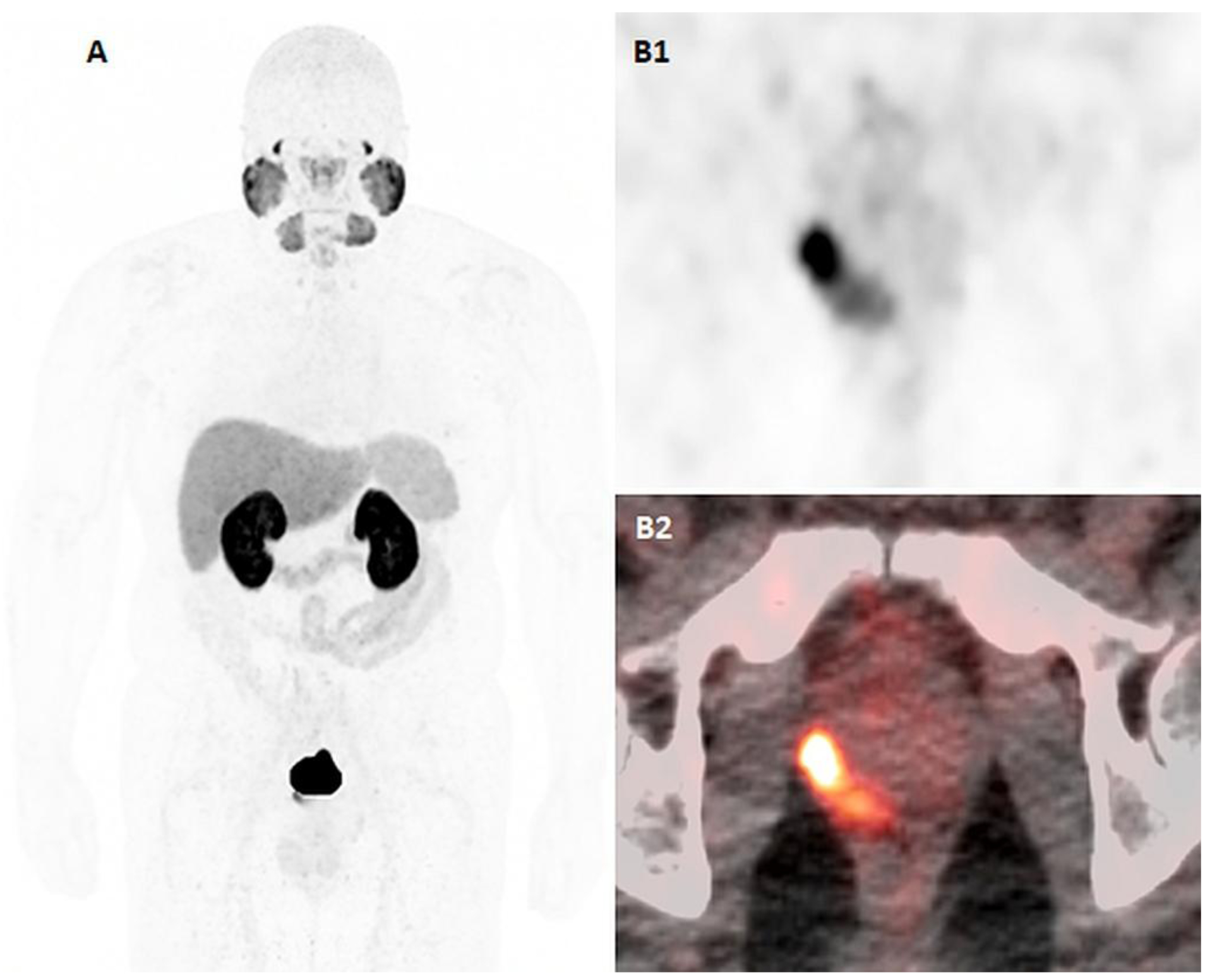 Figure 2: