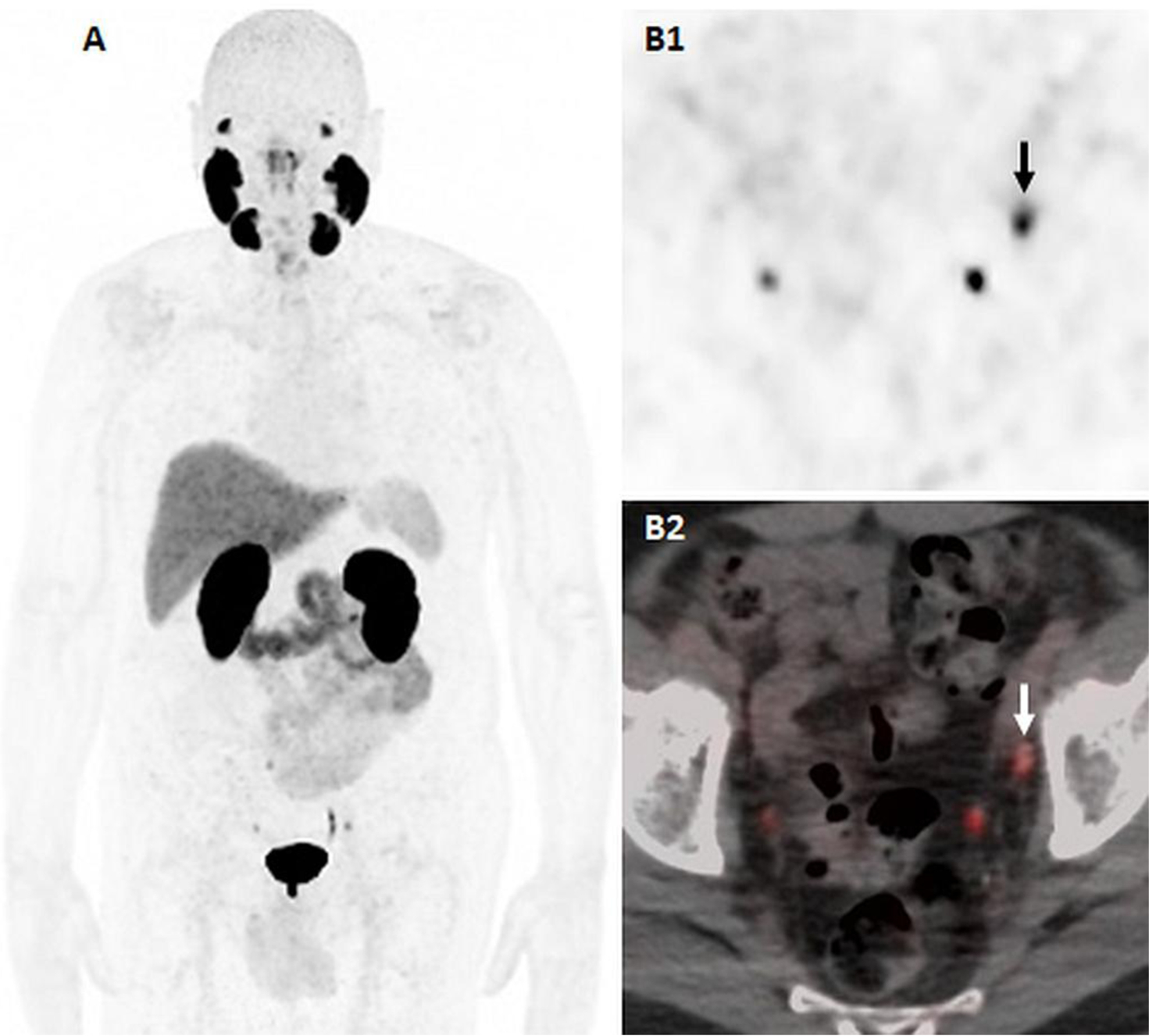 Figure 3: