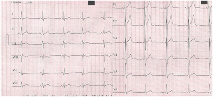 FIGURE 3