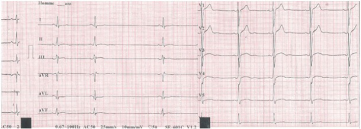 FIGURE 2