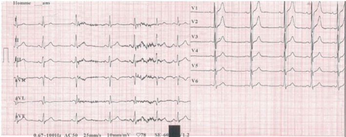 FIGURE 1