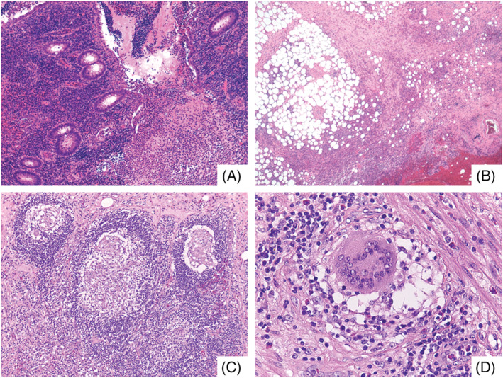 FIGURE 1