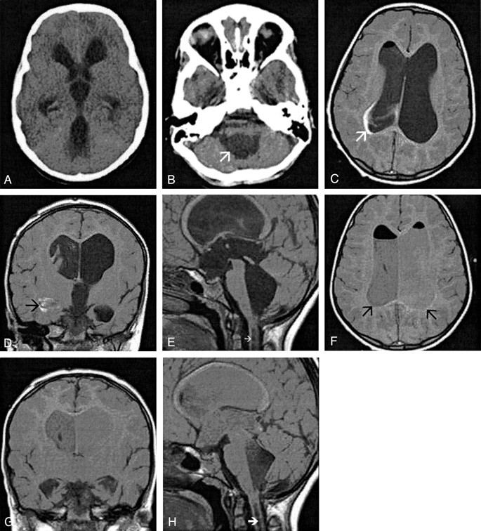 Fig 2.