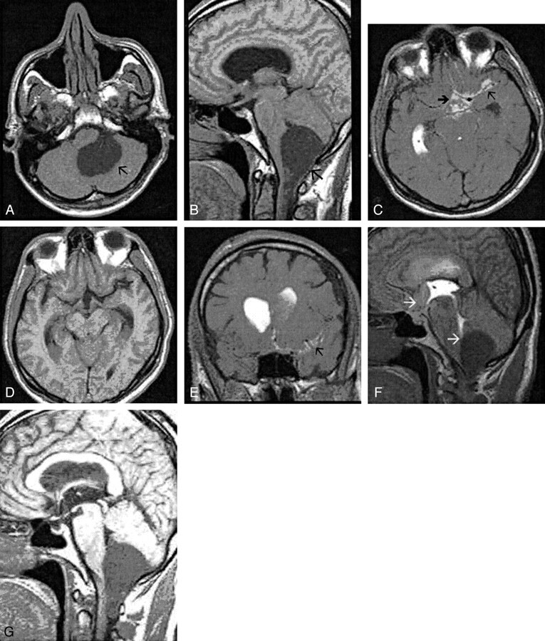 Fig 5.