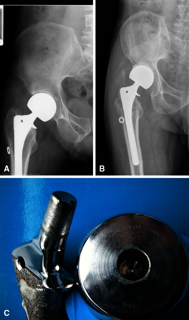 Fig. 2A–C