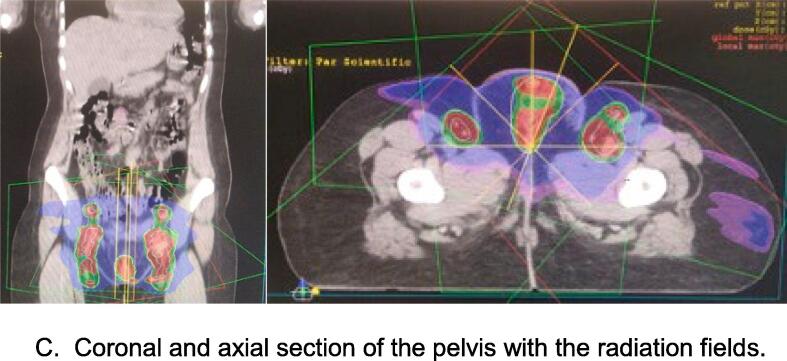 Fig. 2C