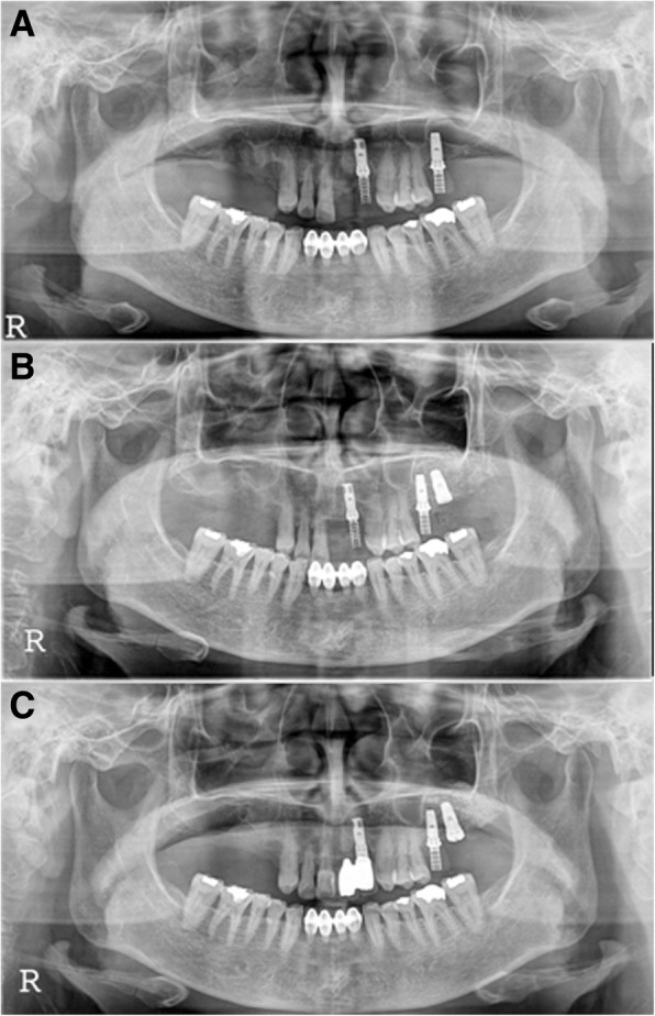 Fig. 6
