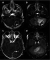 FIG 2