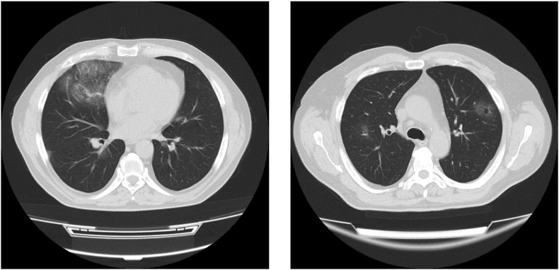 Fig. 1