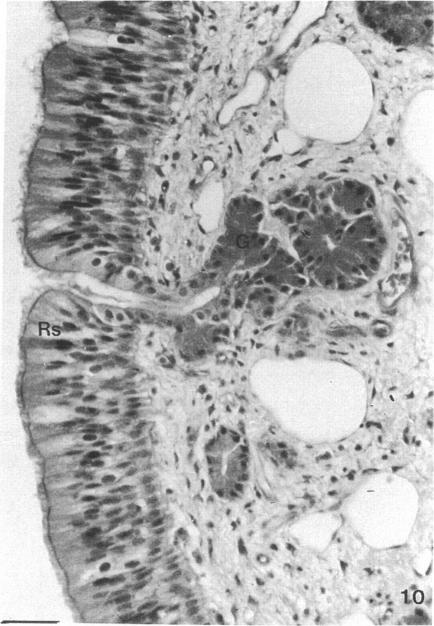 Fig. 10