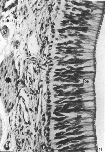 Fig. 11