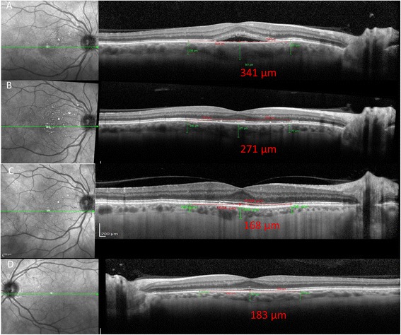 Fig. 2