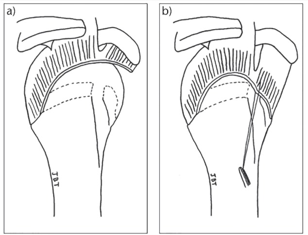 Fig. 11