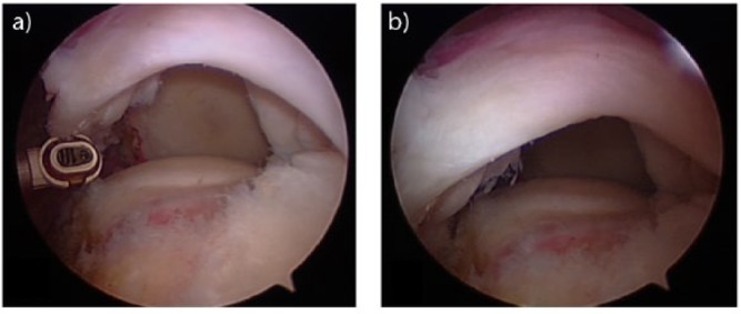 Fig. 9