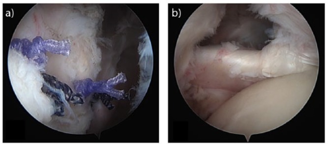 Fig. 13