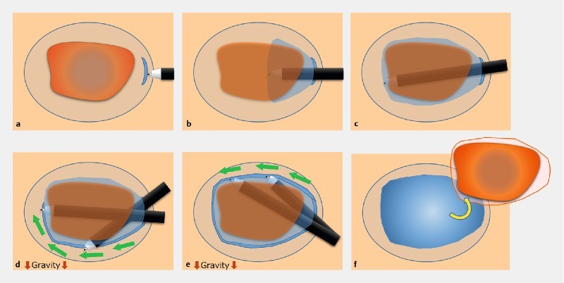 Fig. 3