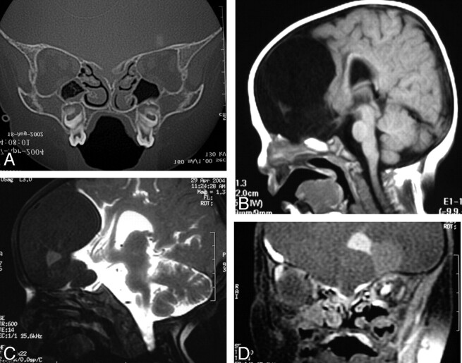 Fig 2.