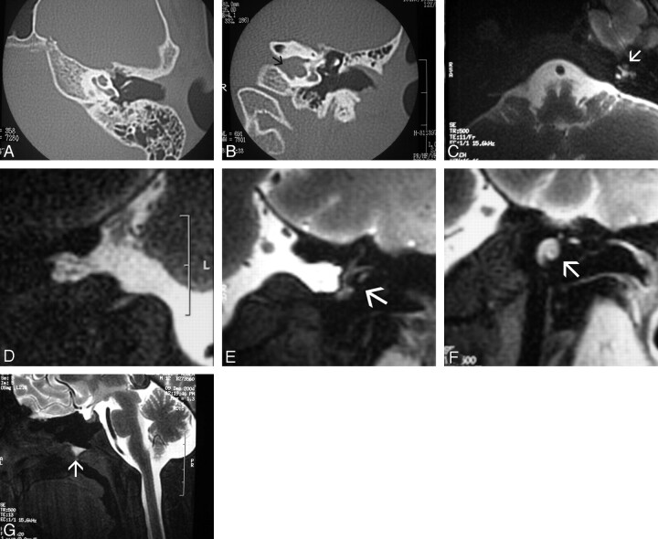 Fig 4.