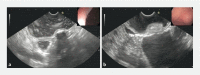 Fig. 1 a