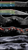 Fig. 6