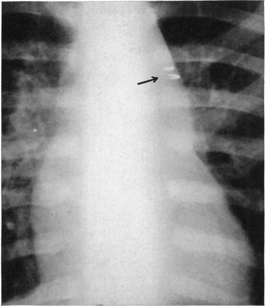 FIG. 14.