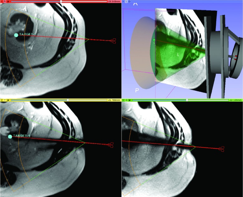 FIG. 4.