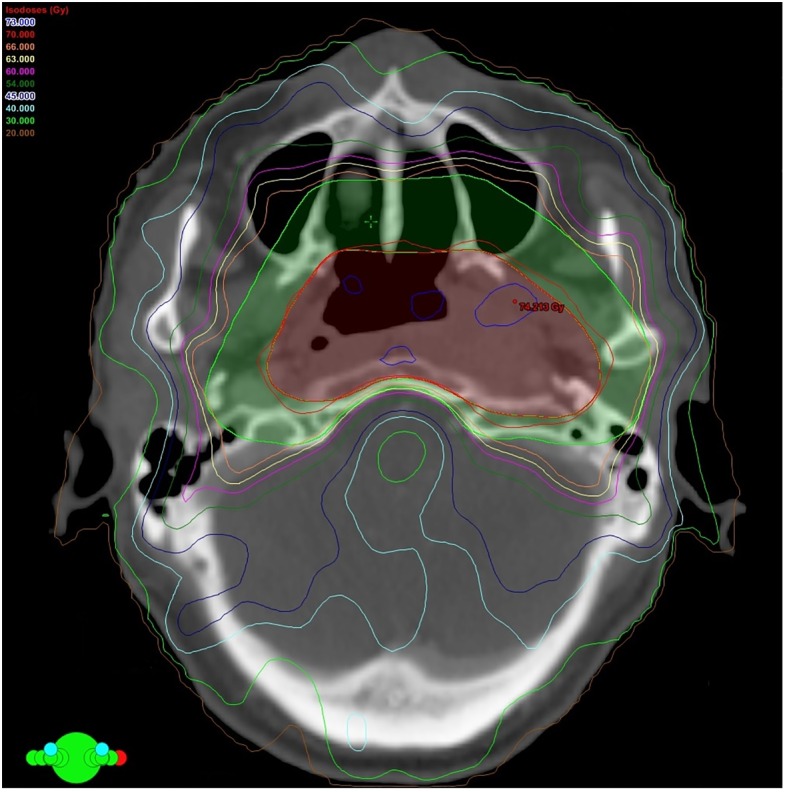 Fig 1