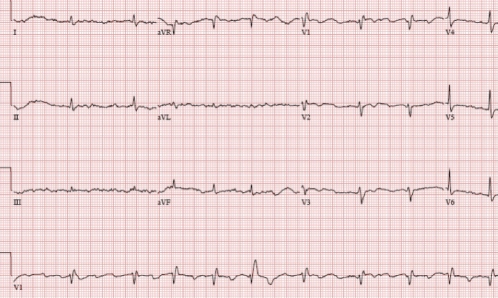 Figure 2)