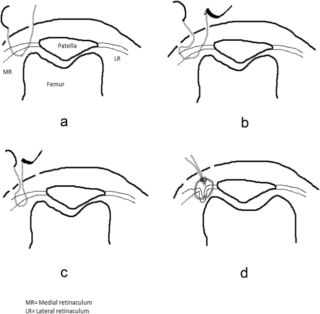 Fig. 2