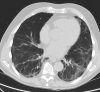 FIGURE 3