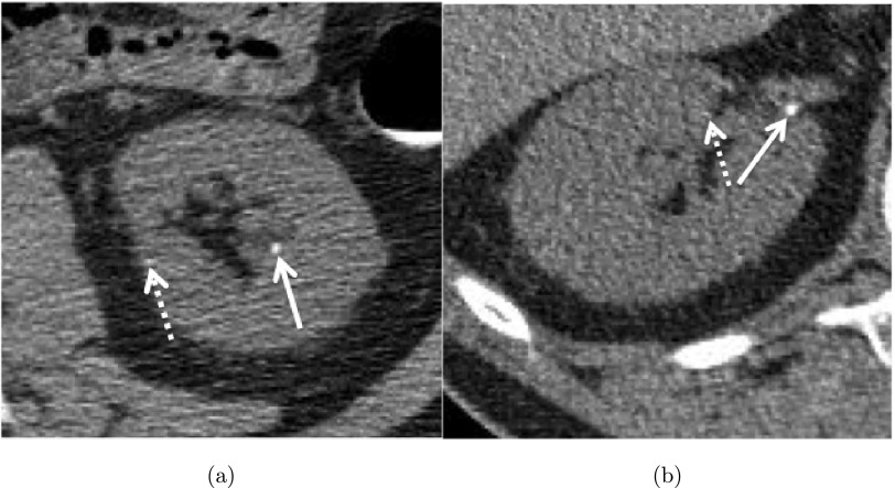 FIG. 1.