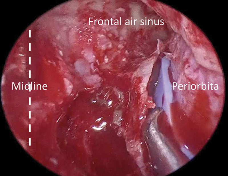 Fig. 26