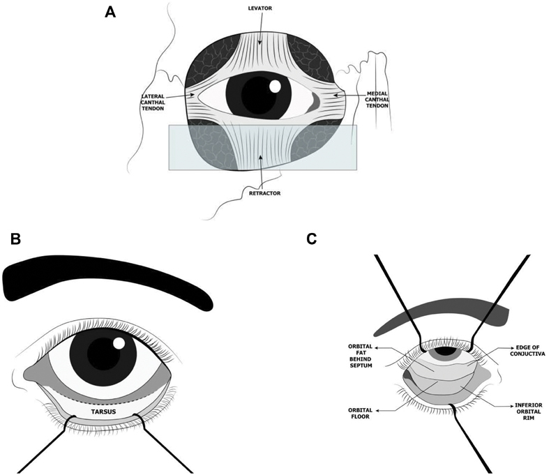 Fig. 22