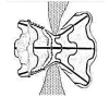 Fig. (1)