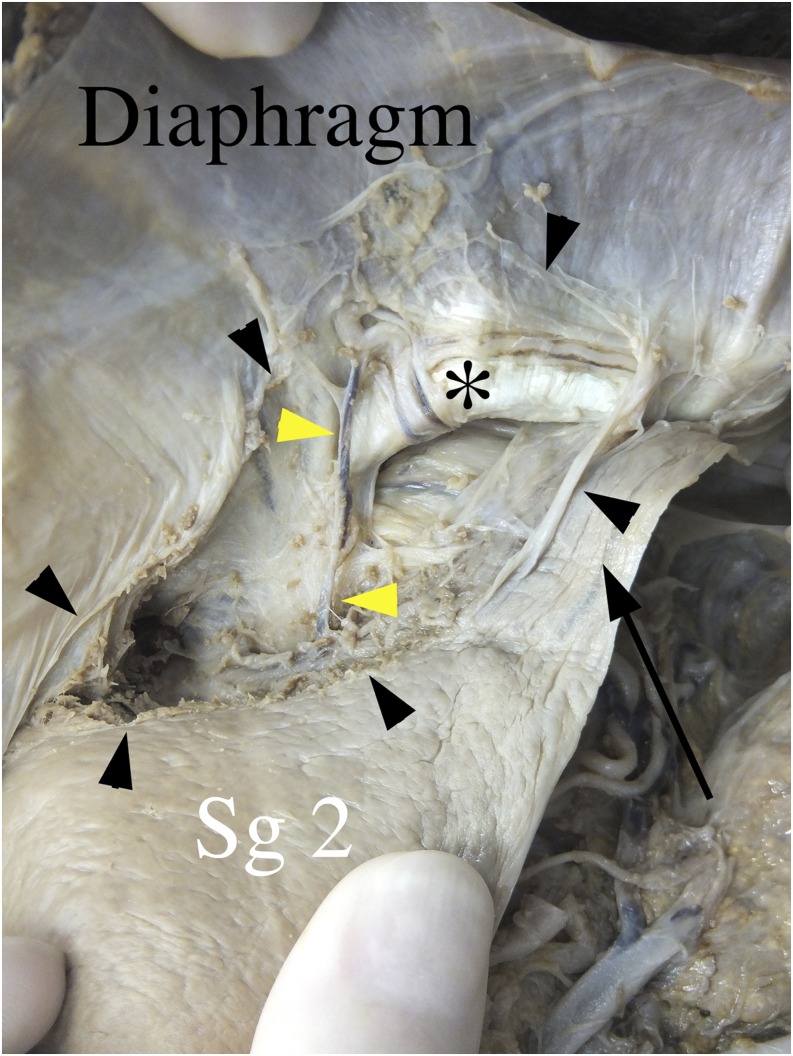 Figure 9.