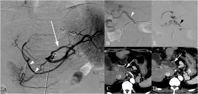 Figure 18.