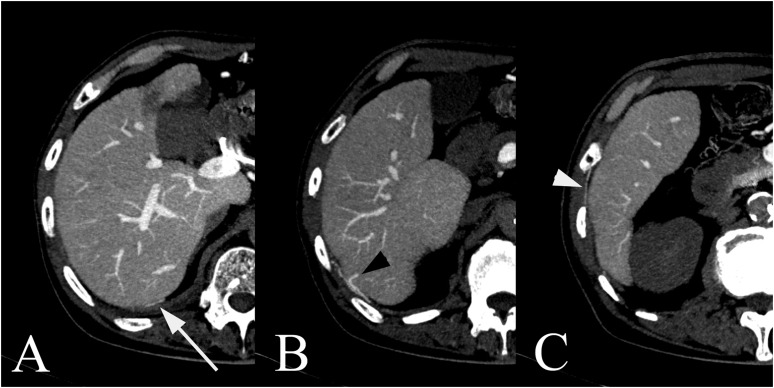 Figure 12.