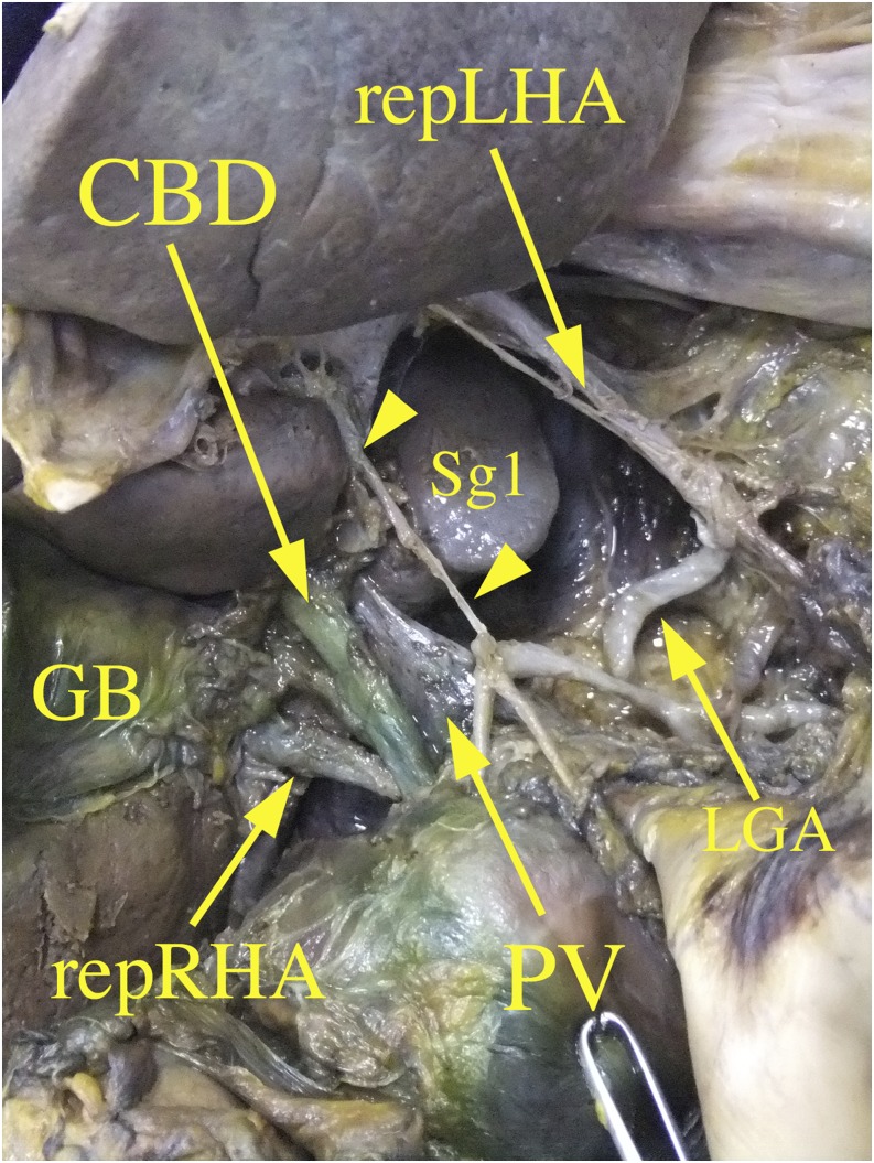 Figure 14.