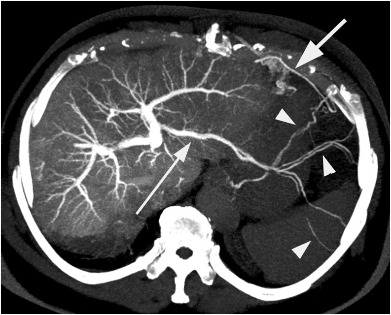 Figure 10.