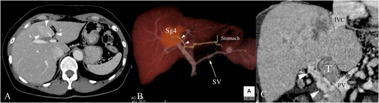 Figure 17.