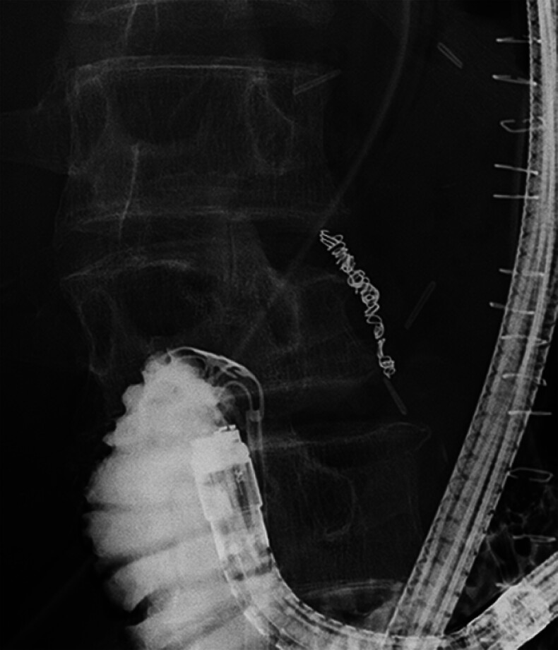 Fig. 5
