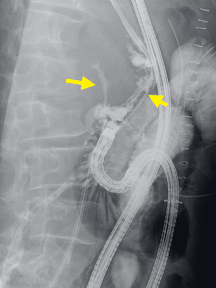 Fig. 2