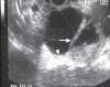 Figure 5)