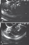Figure 2)