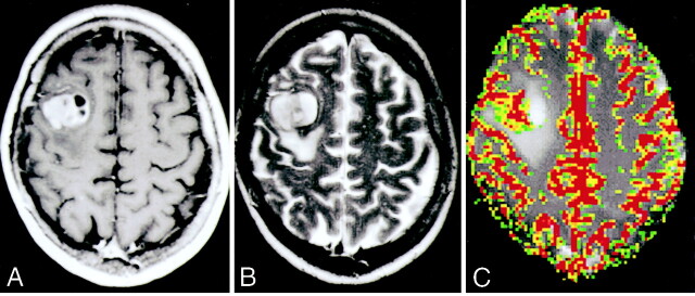 Fig 1.