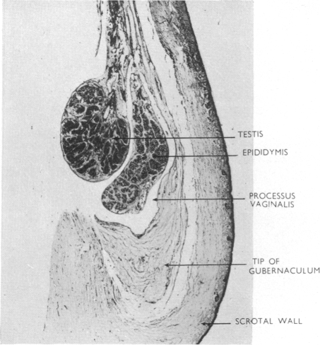 Fig. 13