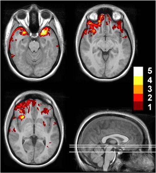 Fig. 1