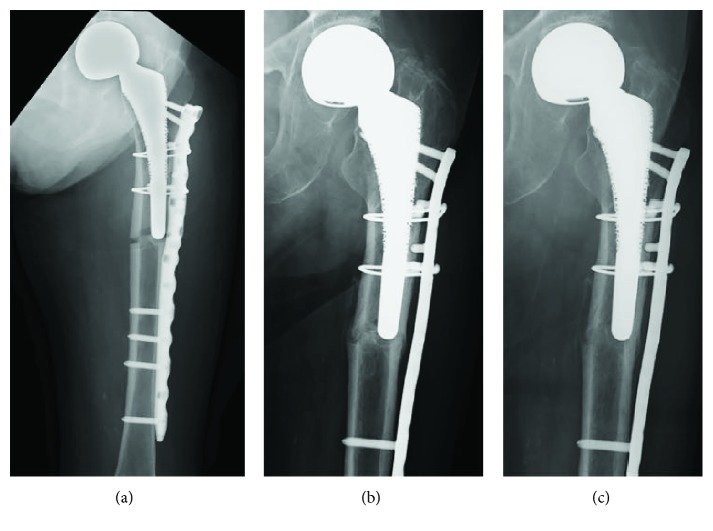 Figure 4