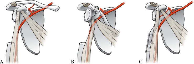 Fig. 1A–C